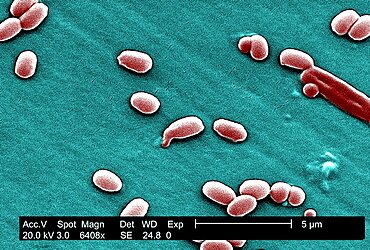 Anthrax Bacterium Spore, Sem