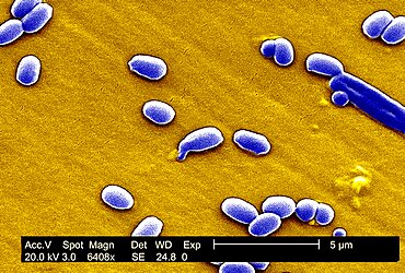 Anthrax Bacterium Spore, Sem