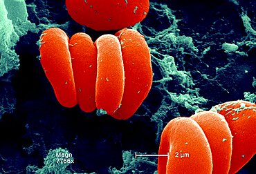 Red Blood Cell & Fibrin, Sem