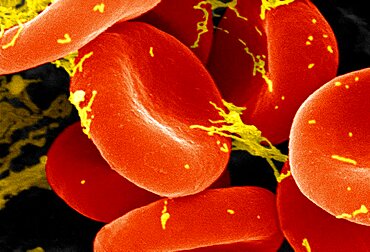 Red Blood Cell, Sem