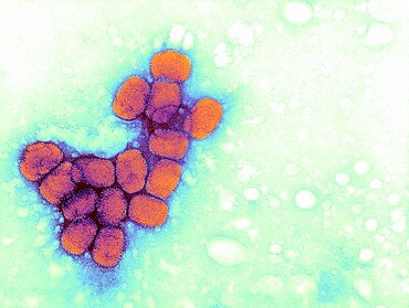 Smallpox Virus