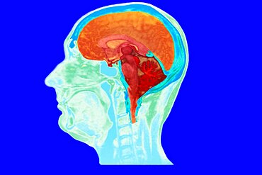 Brain, Drawing