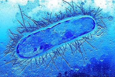 Escherichia Coli, Tem
