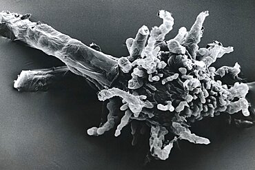 Amoeba Proteus SEM