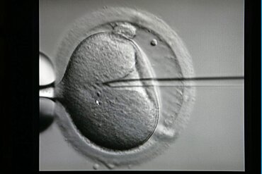 Intracytoplasmic sperm injection