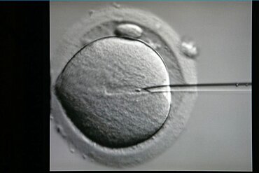 Intracytoplasmic sperm injection