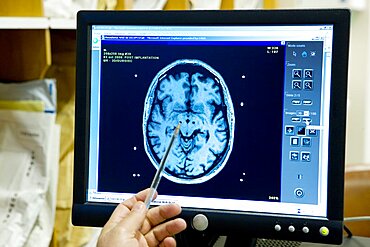 Brain Electrostimulation, MRI