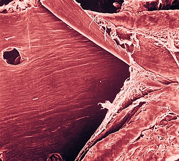 Blood Capillary, SEM