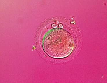 Fertilization, Zygote