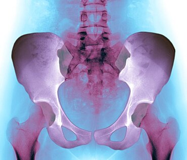 Colorized X-ray image of healthy pelvis