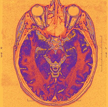 Brain, MRI