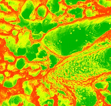 Lung Alveolus, SEM