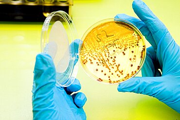 Escherichia Coli