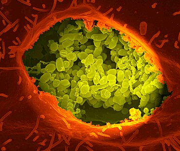 A dry fracture of a Vero cell exposing the contents of a vacuole where Coxiella burnetii are busy growing.