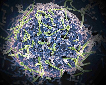 Ebola virus isolated in November 2014 from patient blood samples obtained in Mali. The virus was isolated on Vero cells.