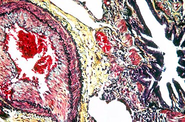 Blood Vessels in Lungs, LM