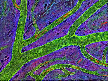 Retina, Fluorescent LM