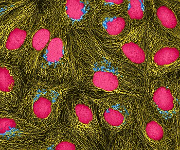 HeLa Cells, MFM