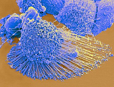 Apoptotic HeLa Cell, SEM