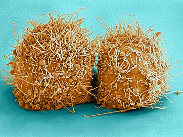 Dividing HeLa Cells, SEM