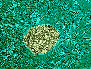 Human Embryonic Stem Cell Line ES05