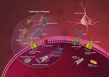 Alzheimer's Disease