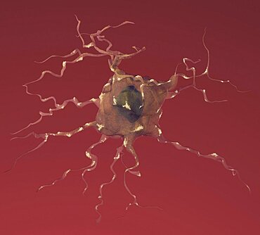 Alzheimer's Disease, Dying Neuron