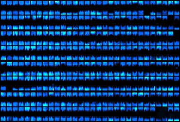 Microfluidic Chip, Bacterial Colonies