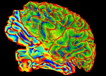 Human Brain, Surface Mapping