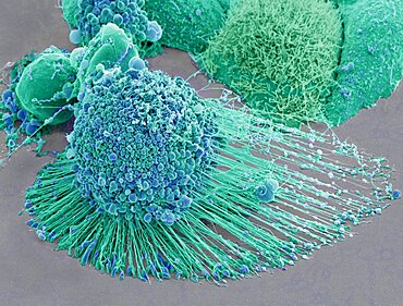 Apoptotic HeLa Cell, SEM