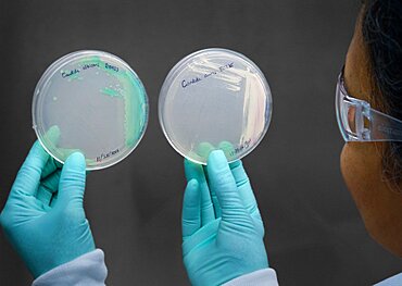 Candida auris Cultures in Laboratory