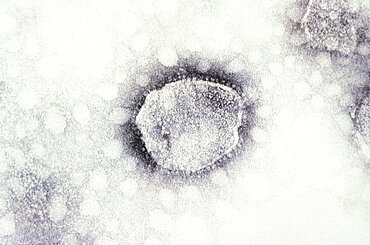 Tacaribe Virus, TEM