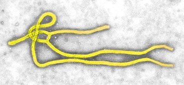 Ebola Virus, TEM