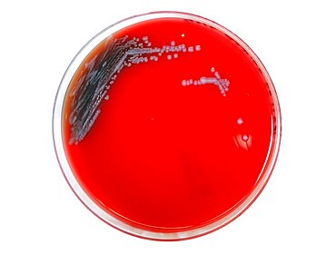 Petri Dish with Plague Bacteria