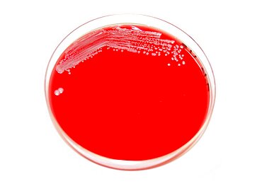 Petri Dish with Plague Bacteria