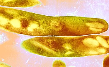 Mycobacterium tuberculosis Bacteria, TEM