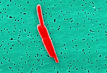 Sebaldella termitidis Bacteria Dividing, SEM