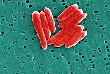 Sebaldella termitidis Bacteria Dividing, SEM