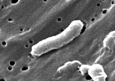 Vibrio cholerae Bacteria, SEM