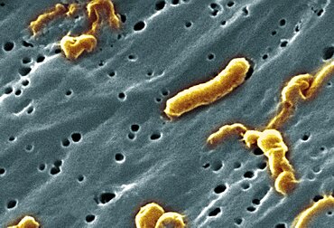 Vibrio cholerae Bacteria, SEM