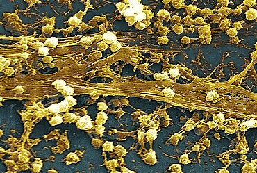 Staphylococcus aureus Bacteria, SEM