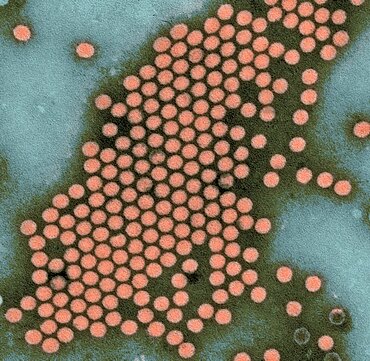 Human Enterovirus, Poliovirus, TEM