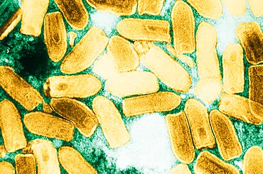 Vesicular Stomatitis Virus, TEM