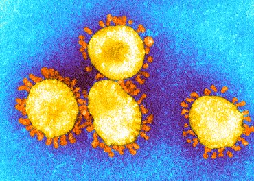 SARS Coronavirus, TEM