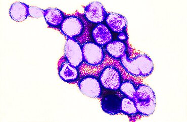 Rubella Virus, German Measles, TEM