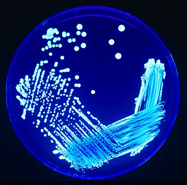 Legionella pneumophila Bacteria, Culture Plate