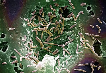 Mycobacterium chelonae Bacteria, SEM