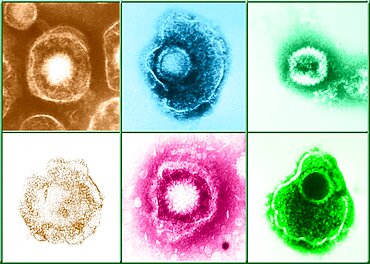 Herpesviridae Virus Family, Examples, TEM