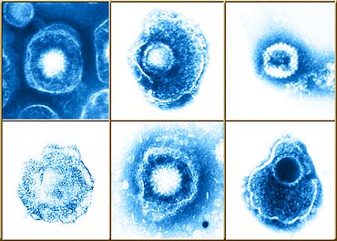 Herpesviridae Virus Family, Examples, TEM