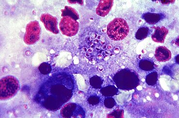 Histoplasma capsulatum, Histoplasmosis, LM